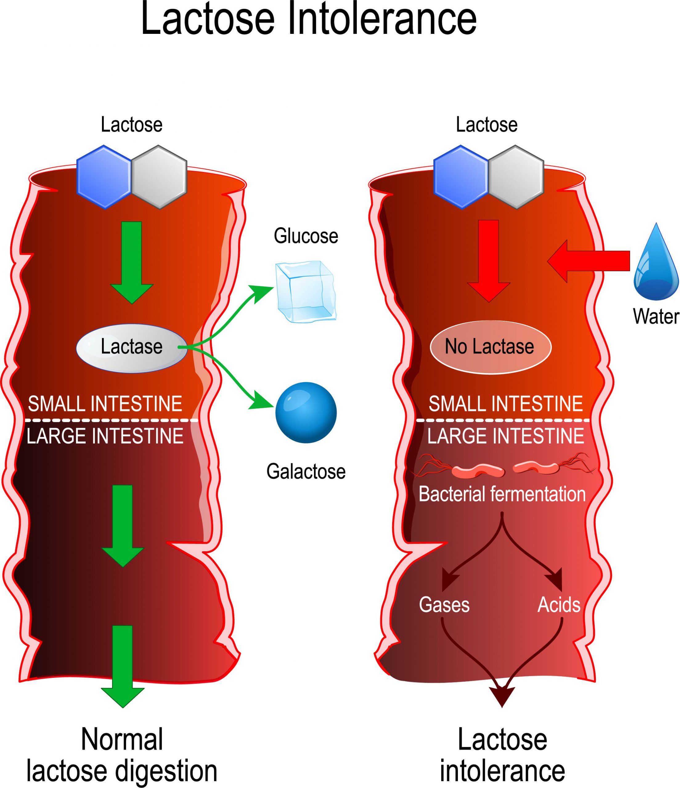 Does Lactose Intolerance Make You Itchy