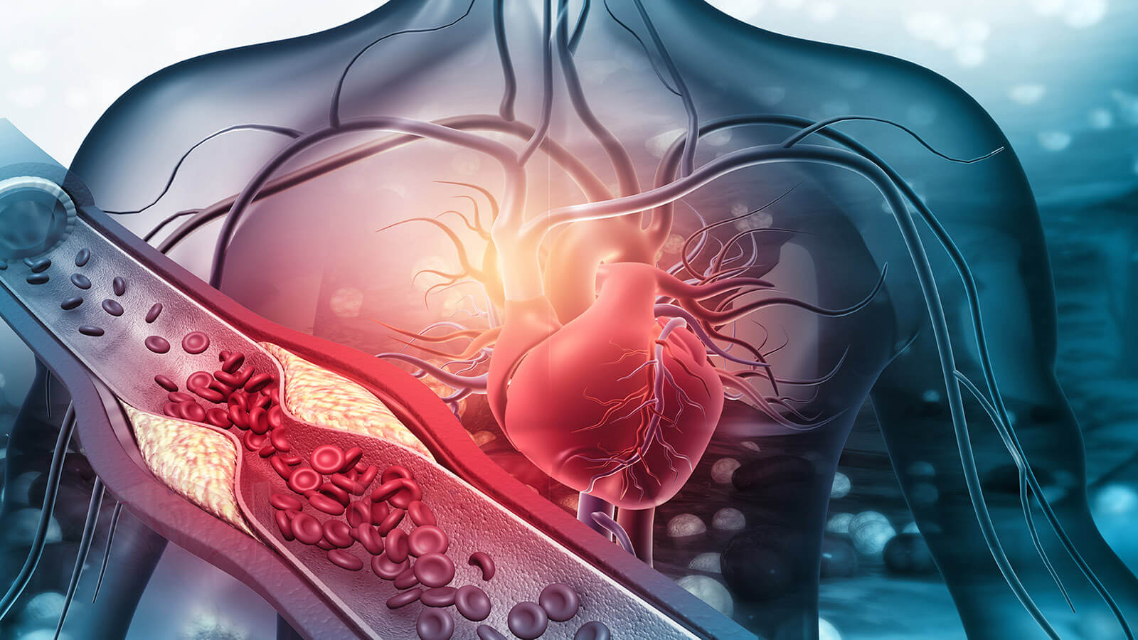 FISH Beneficial for Diagnosing Cholangiocarcinoma | PracticeUpdate